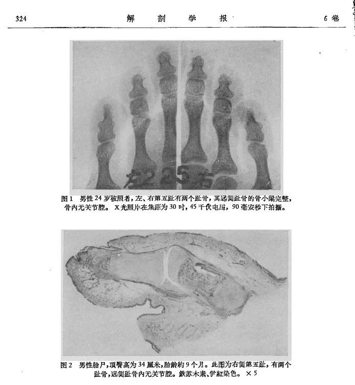 人体共有206块骨头 中国人却普遍只有204块 少的两块哪儿去了？