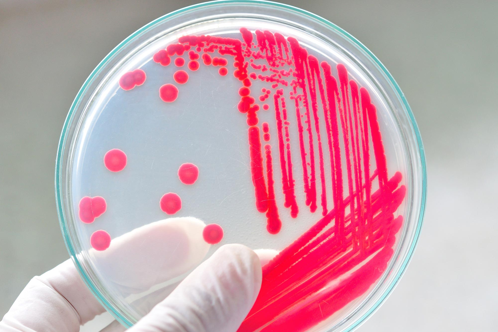 Holding-Petri-Dish-With-Bacteria(1).jpg